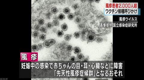 2018年日本爆发风疹旅游应该注意事项
